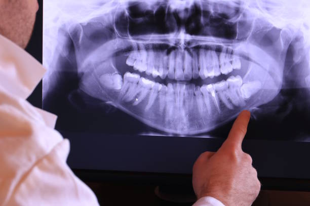 Best Emergency Root Canal Treatment in Gleed, WA